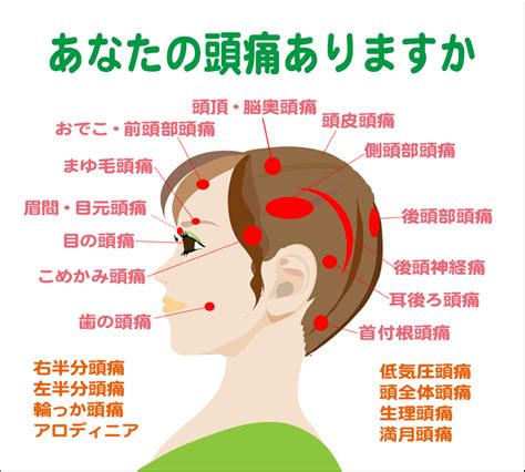 頭痛 原因|頭が痛いときに考えられる原因は？頭痛の種類と症状。